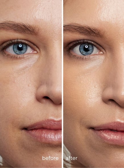 uneven skin tone