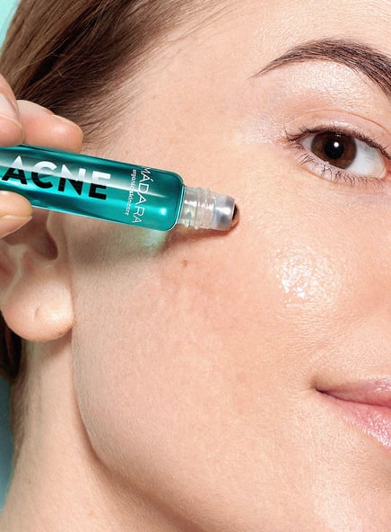 How to get rid of acne