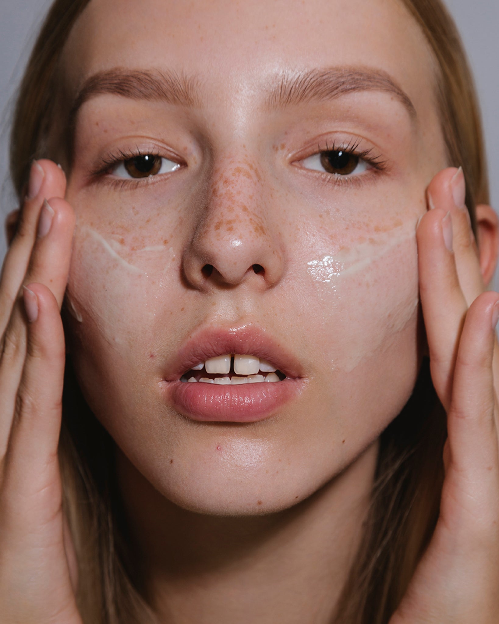 Skincare treatment for acne prone skin