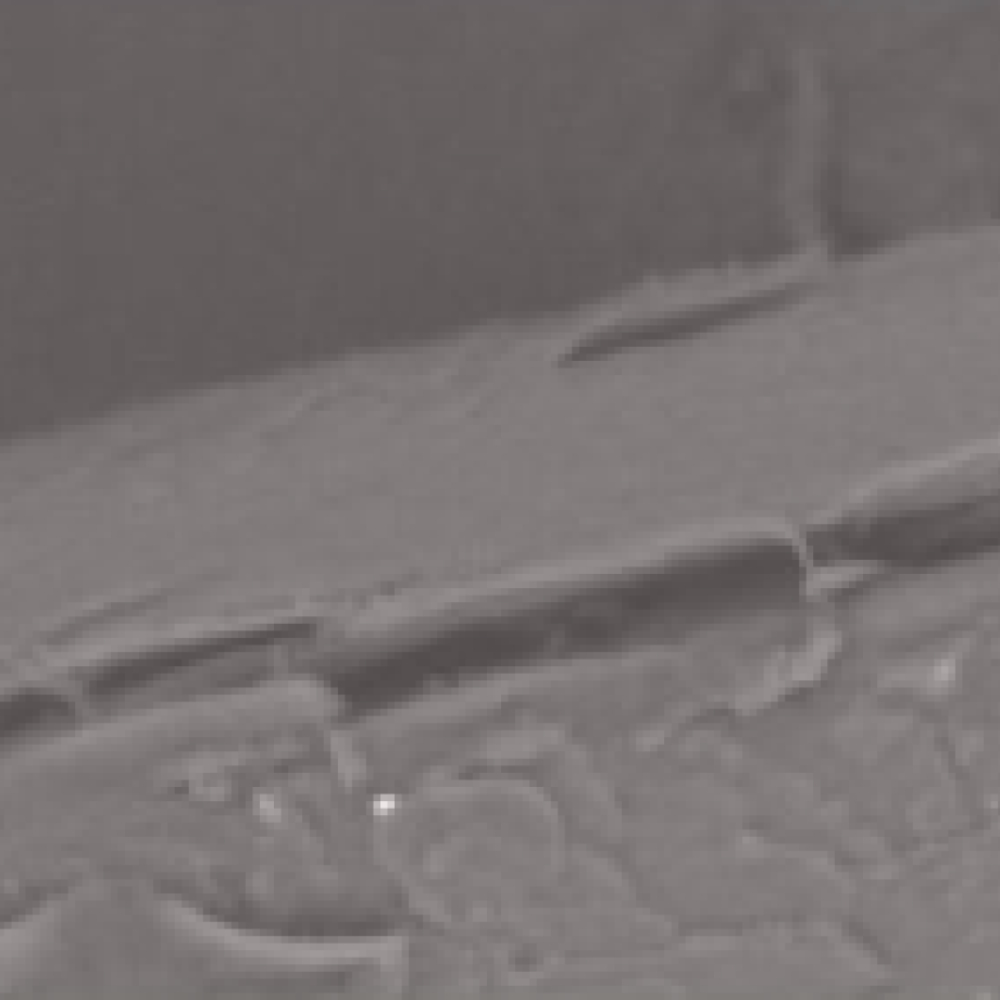 before madara grow conditioner Ex vivo study, scanning electron microscopy, magnification 800x