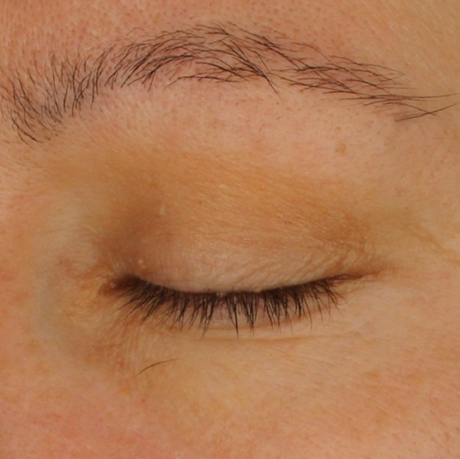 close-up of womans eyelid after using Madara retinol alternative Plant-Powered Eye Serum