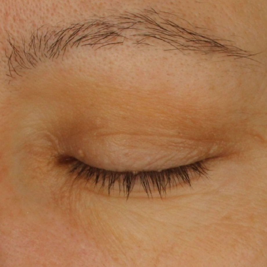close-up of womans eyelid before using Madara retinol alternative Plant-Powered Eye Serum