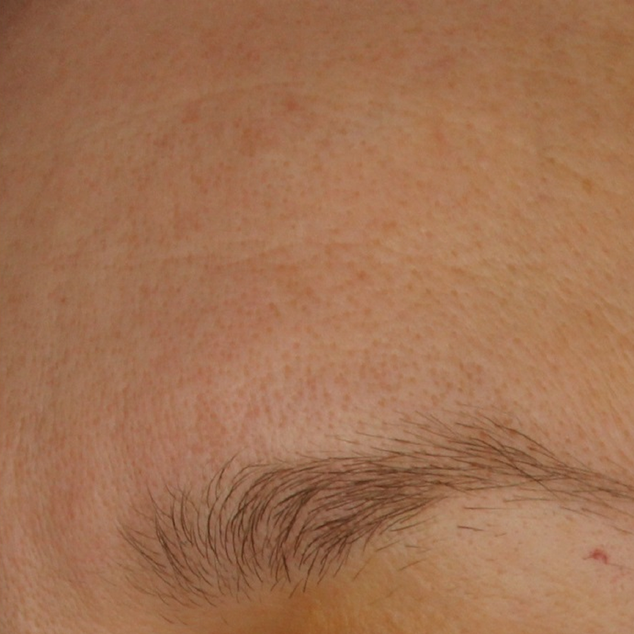 close-up of womans forehead after using Madara retinol alternative night cream