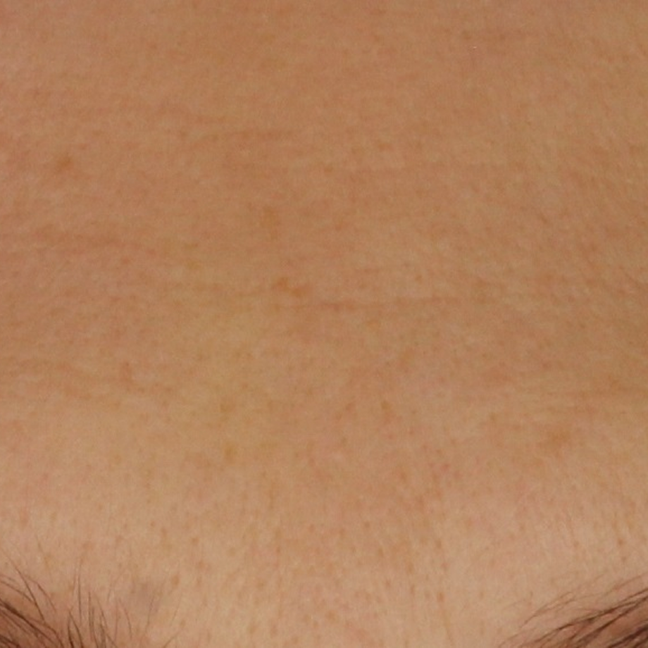 close-up of womans forehead before using Madara retinol alternative day cream