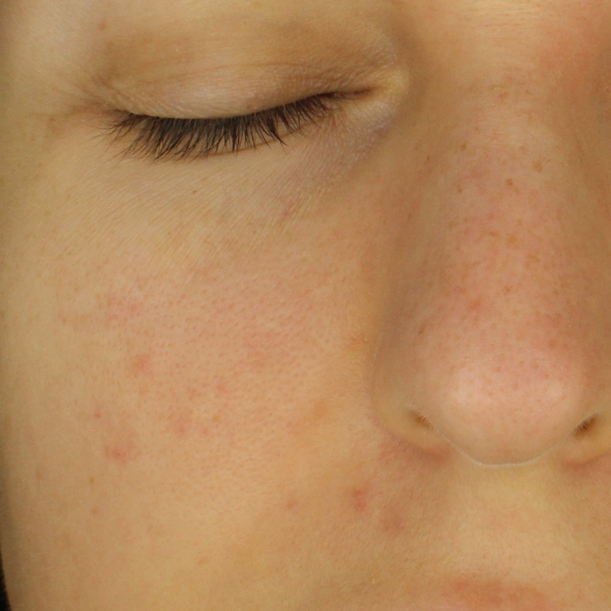 facial skin after madara niacinamide serum
