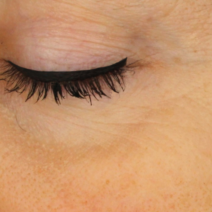 facial skin after madara kojic pant-powered retinol alternative serum