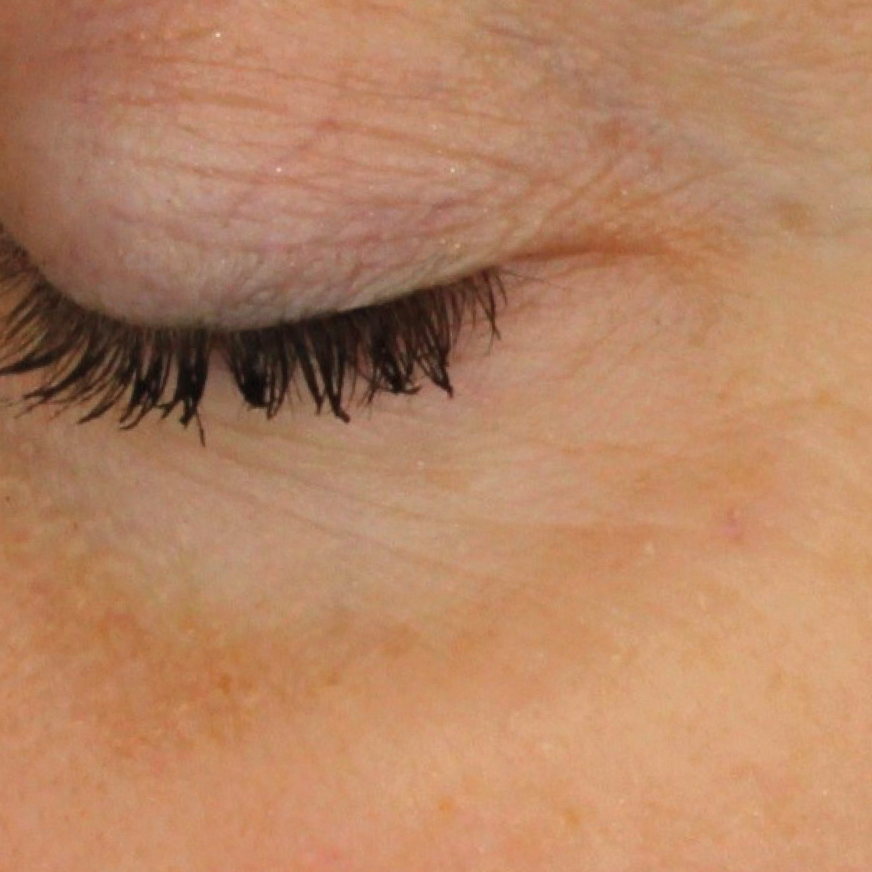 facial skin before madara kojic pant-powered retinol alternative serum