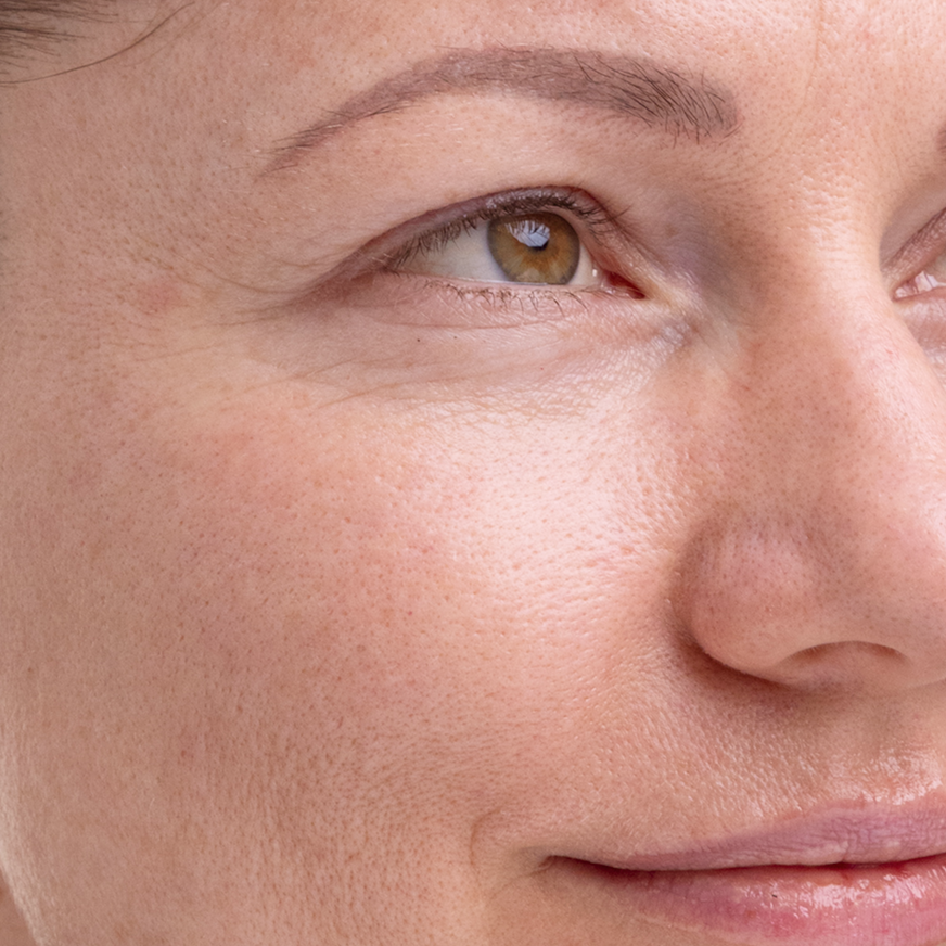 facial skin after madara kojic alternative pigment serum