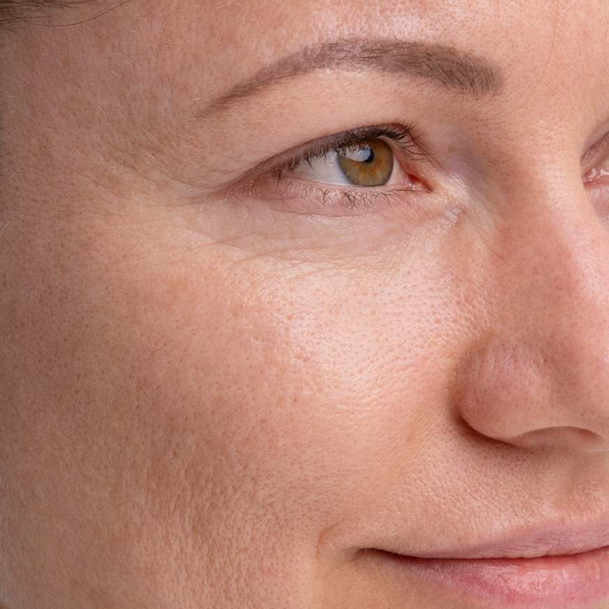 facial skin before madara kojic alternative pigment serum