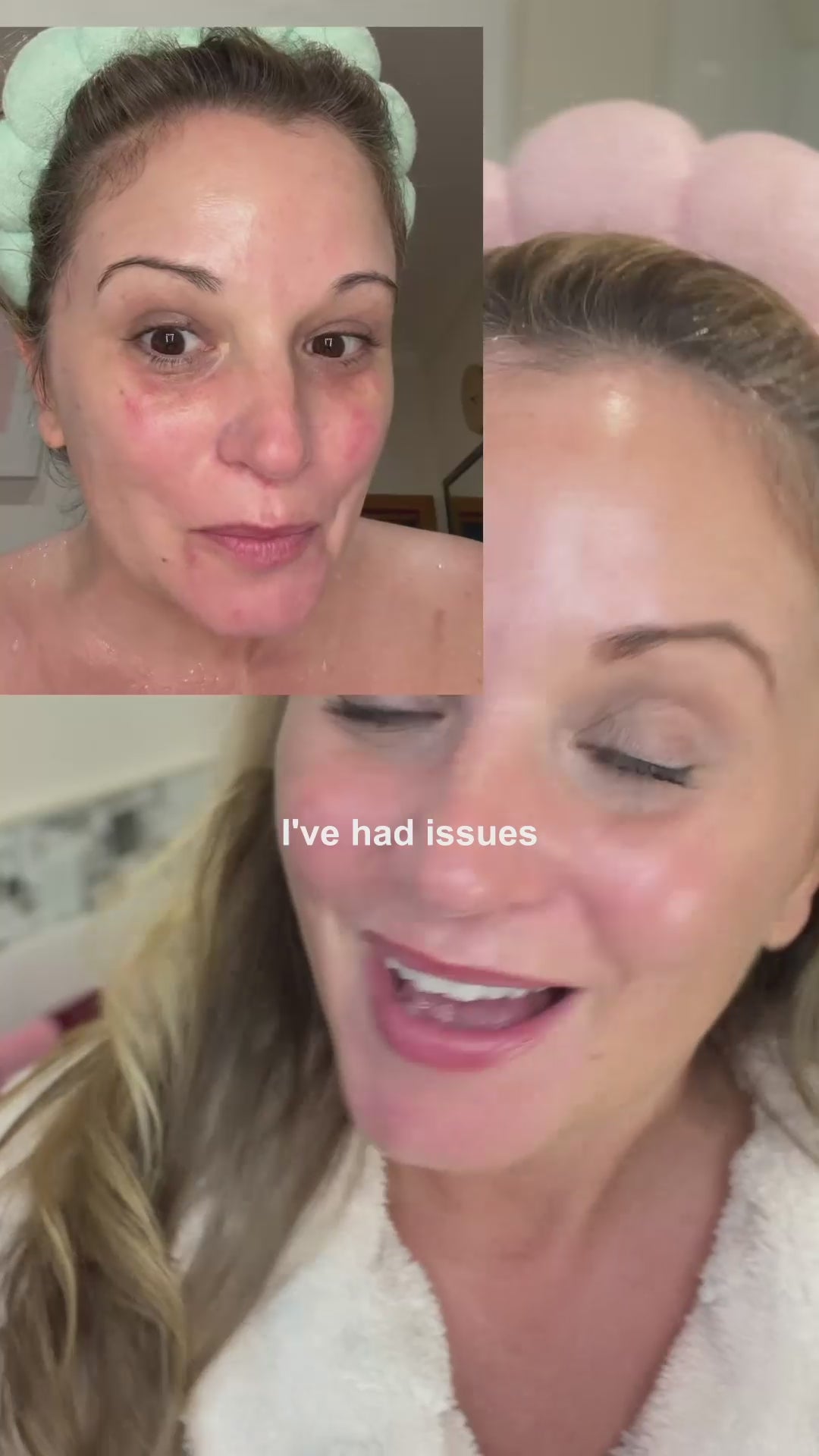 Load video: retinol altenative ugc without irritation 