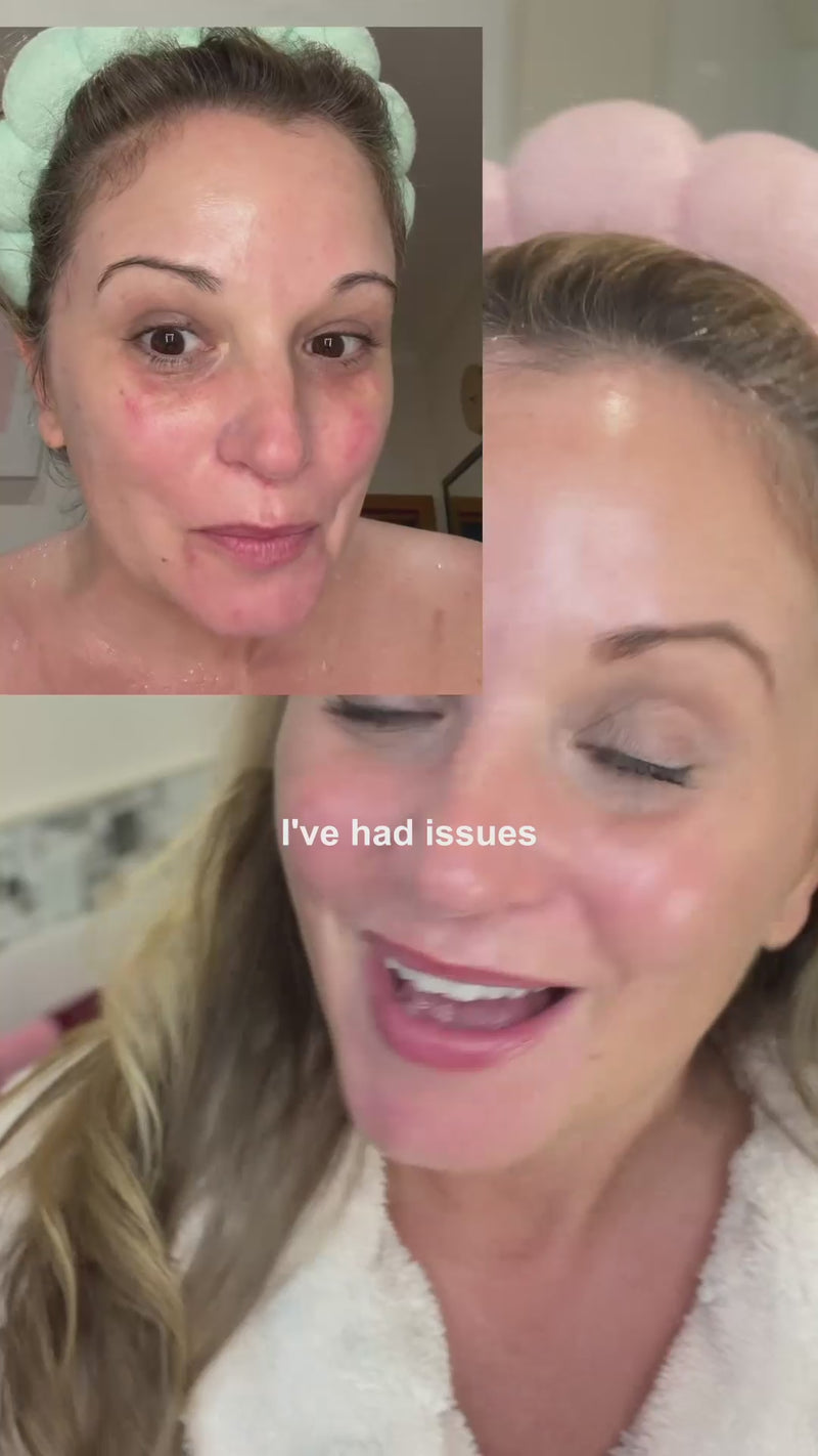 retinol altenative ugc without irritation 